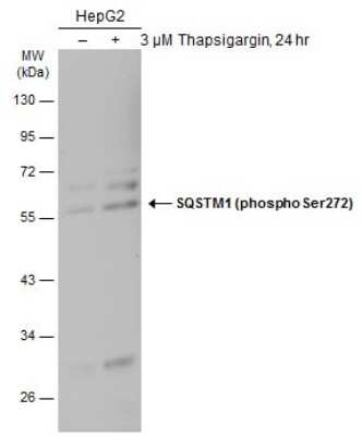 Western Blot: p62/SQSTM1 [p Ser272] Antibody [NBP3-13316]